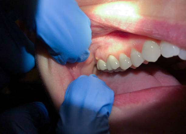 Best Same-Day Emergency Dentist in Healdsburg, CA